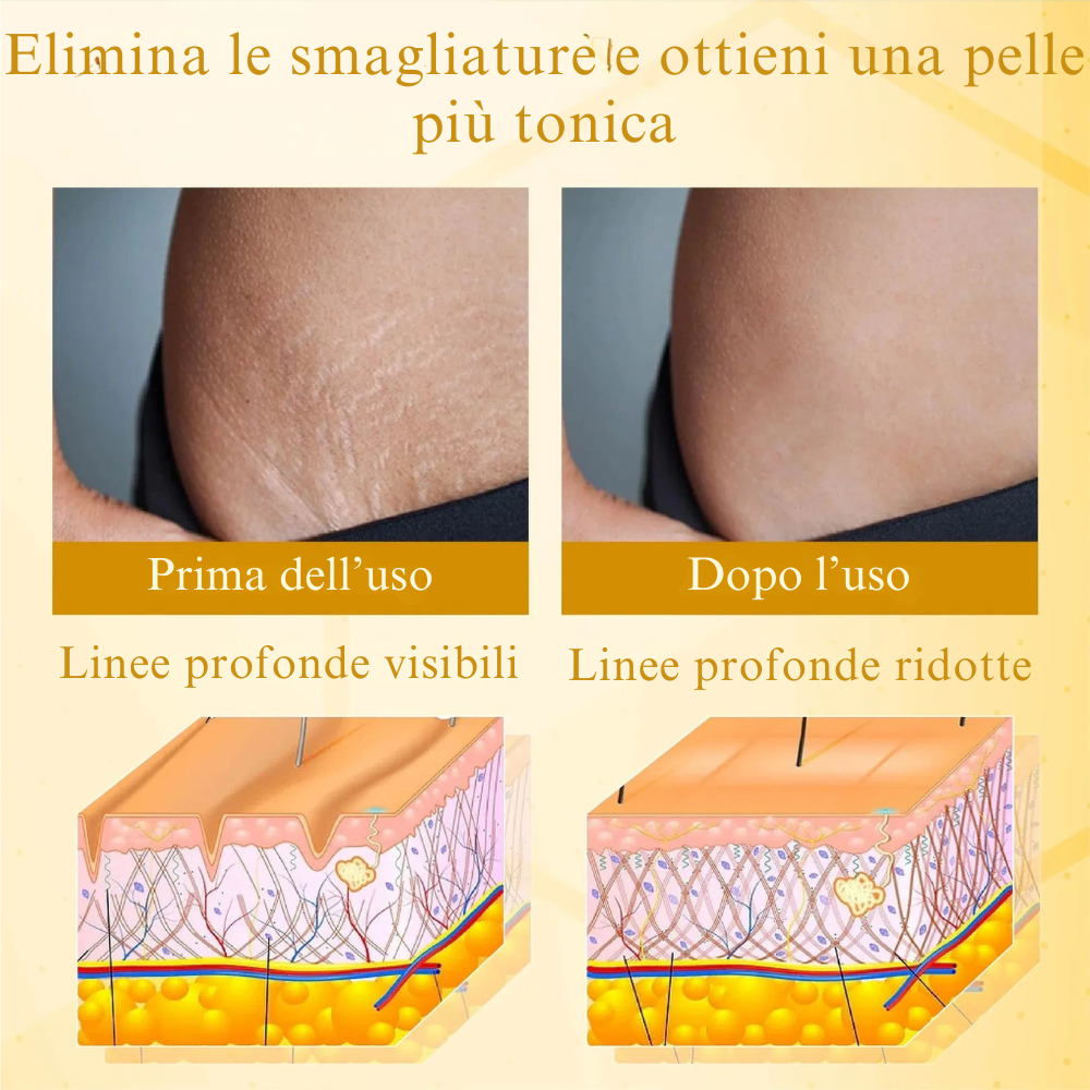 Venolift | Crema Rassodante Avanzata Multi-Azione