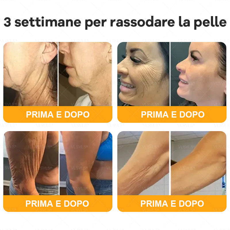 Prodotto e spedito dall’Italia 🇮🇹 VLSVLS® Crema Rigenerante alla Tossina d’Ape 🔥 ULTIMO GIORNO: -80%