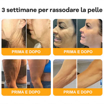 Prodotto e spedito dall’Italia 🇮🇹 VLSVLS® Crema Rigenerante alla Tossina d’Ape 🔥 ULTIMO GIORNO: -80%