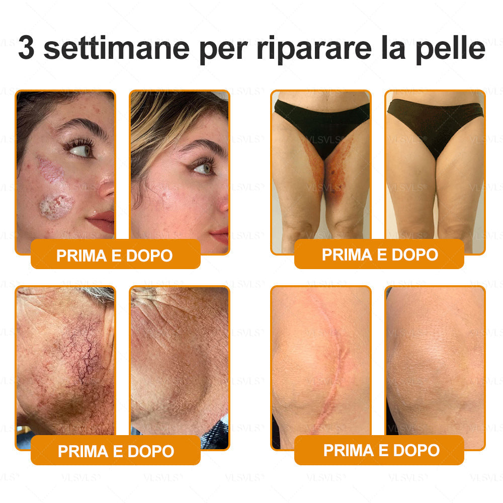 Prodotto e spedito dall’Italia 🇮🇹 VLSVLS® Crema Rigenerante alla Tossina d’Ape 🔥 ULTIMO GIORNO: -80%