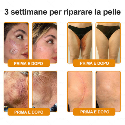 Prodotto e spedito dall’Italia 🇮🇹 VLSVLS® Crema Rigenerante alla Tossina d’Ape 🔥 ULTIMO GIORNO: -80%