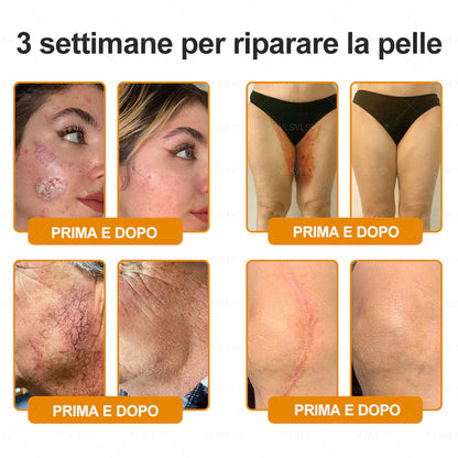 Prodotto e spedito dall’Italia 🇮🇹 VLSVLS® Crema Rigenerante alla Tossina d’Ape 🔥 ULTIMO GIORNO: -80%