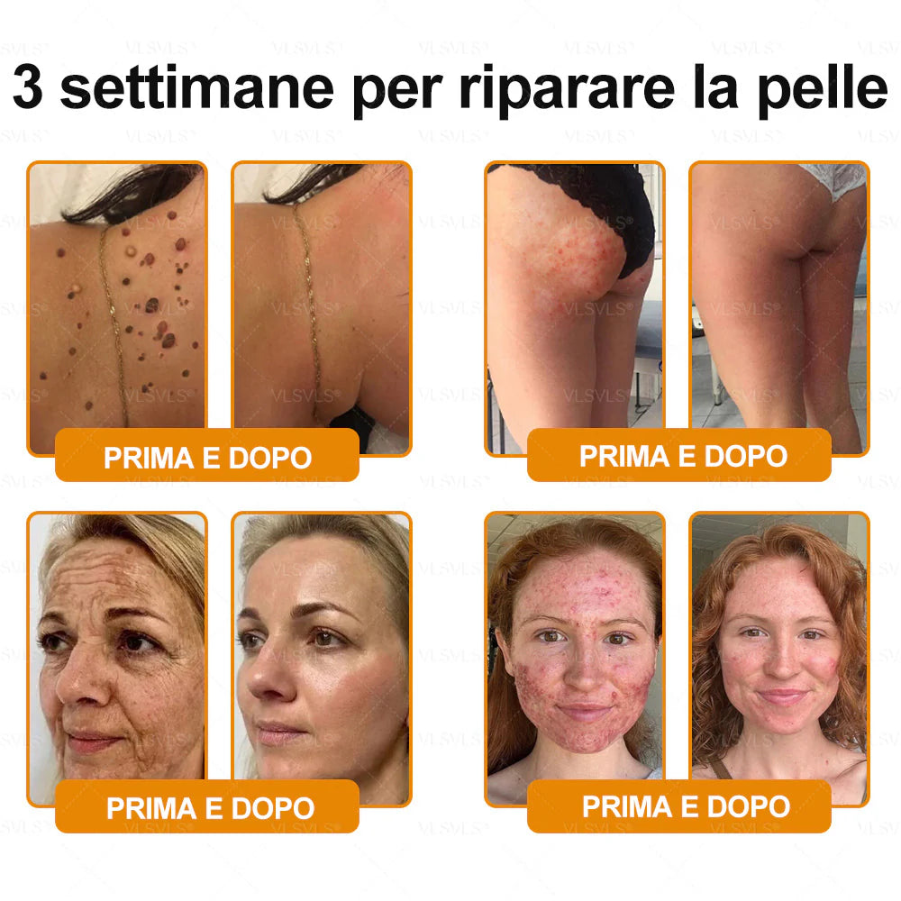 Prodotto e spedito dall’Italia 🇮🇹 VLSVLS® Crema Rigenerante alla Tossina d’Ape 🔥 ULTIMO GIORNO: -80%